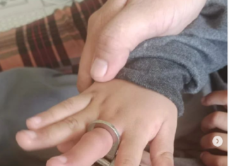 Petugas Damkar Evakuasi Anak yang Jarinya Terjepit Lubang Slot Jendela