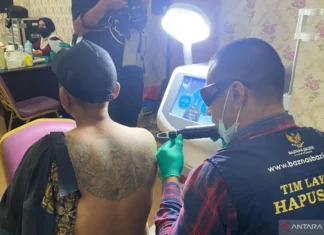 Bahagianya Ahmad bisa Hapus Tato Gratis di Jakarta Selatan