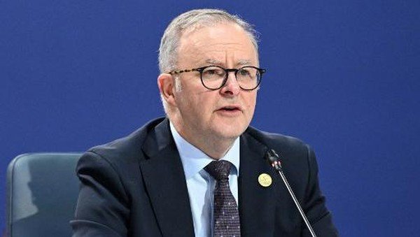 ANTHONY ALBANESE