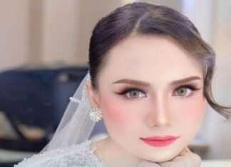 Model Profesional Ansy Jan De Vries Diduga Jadi Korban Begal di Kebon Jeruk